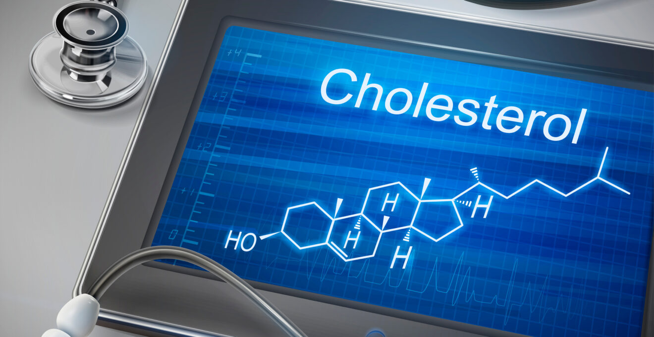 cholesterol online